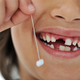 Illustration for article titled Baby Teeth Stories